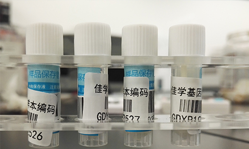 【佳學(xué)基因檢測(cè)】如何做非梗阻性無(wú)精子癥基因解碼、<a href=http://m.njxld.com/tk/jiema/cexujishu/2021/31933.html>基因檢測(cè)</a>？