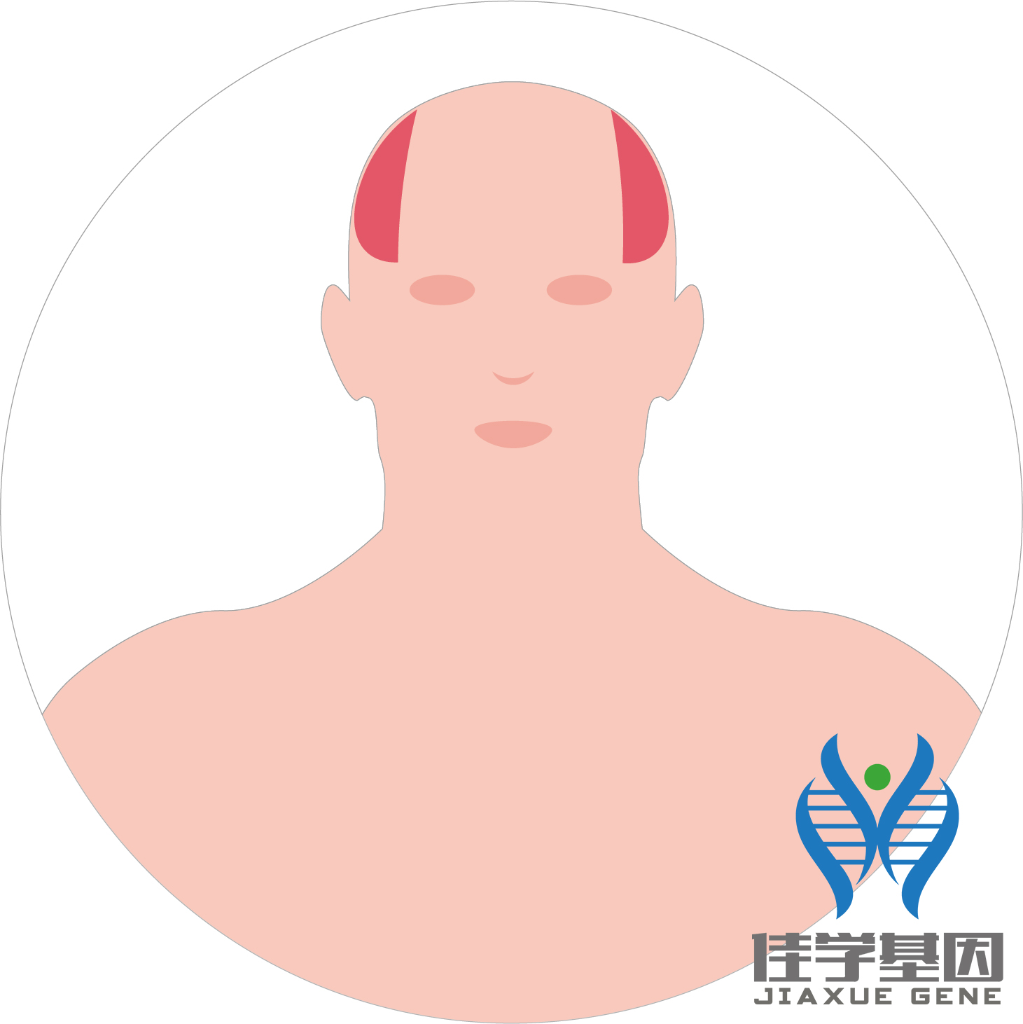 【佳學(xué)基因檢測(cè)】男性<font color='red'>脫發(fā)</font>（Androgenetic alopecia）基因解碼、<a href=http://m.njxld.com/tk/jiema/cexujishu/2021/31933.html>基因檢測(cè)</a>