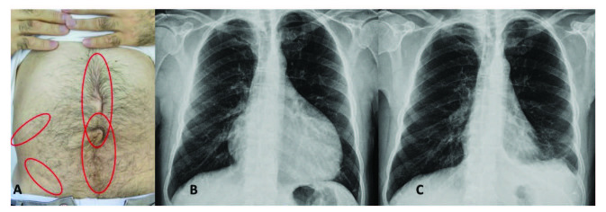 包含圖片、插圖等的外部文件。對象名稱為 turkjmedsci-50-1591-fig001.jpg